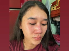 Oknum Polisi Diduga Menganiaya Wanita Muda, Wajah Korban Memar-Memar